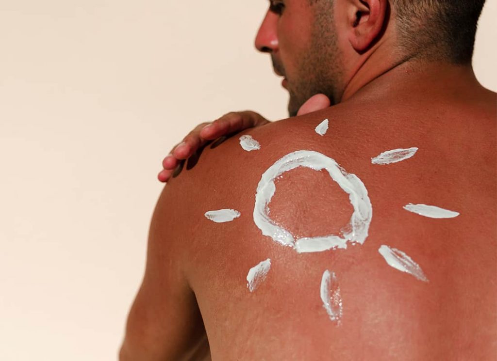 AYURVEDIC REMEDIES FOR SUNBURN