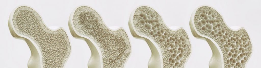 AYURVEDA FOR STRONG BONES