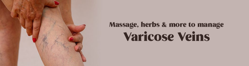 Massage, herbs & more to manage varicose veins