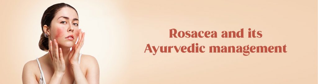 Rosacea and its Ayurvedic management