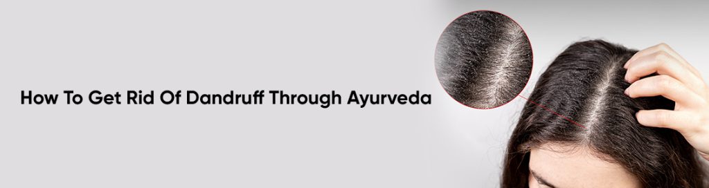 How To Get Rid Of Dandruff Through Ayurveda