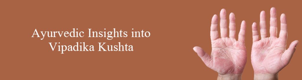 Ayurvedic Insights into Vipadika Kushta
