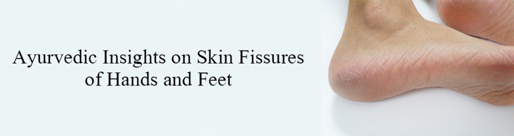 Ayurvedic Insights on Skin Fissures of Hands and Feet
