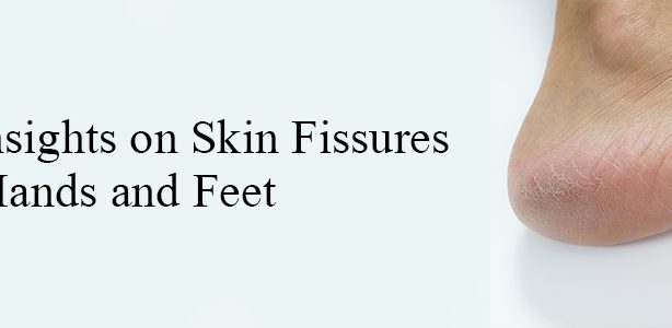 Ayurvedic Insights on Skin Fissures of Hands and Feet